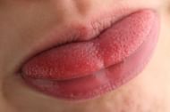 Some home remedies can help for swollen taste buds (Photo by medical news today)